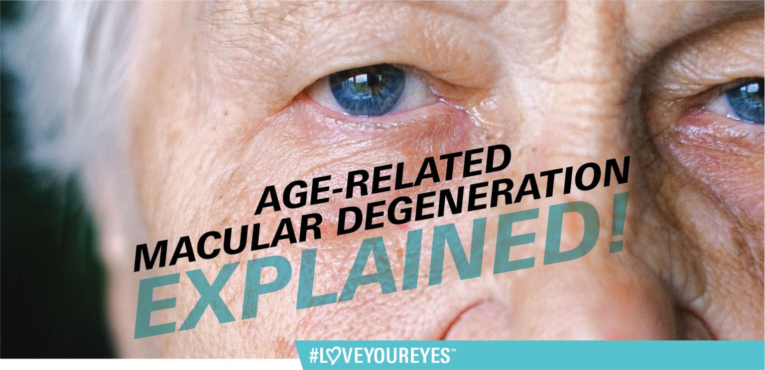 Age-Related Macular Degeneration Explained
